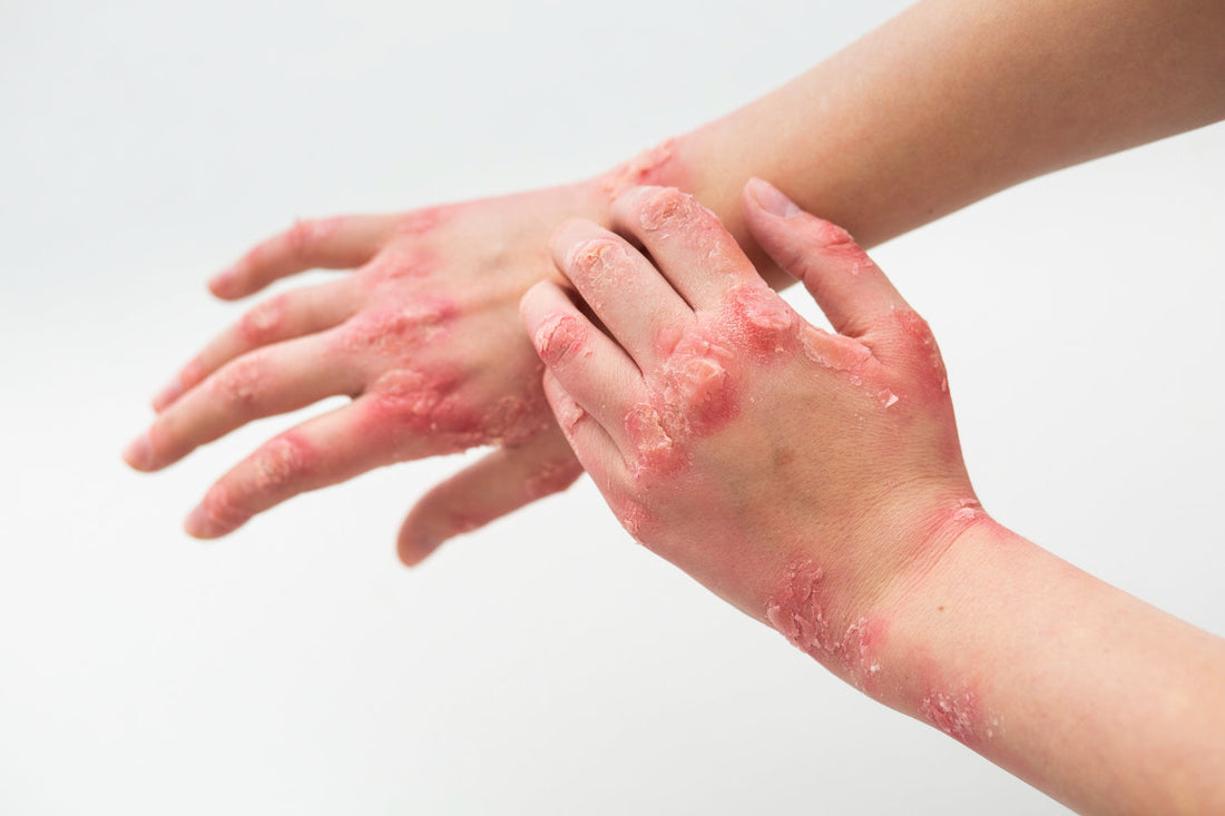 Phyoris: Revolutionizing Skincare with Science and Nature
