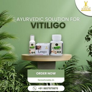 Vitiligo Treatment